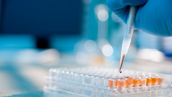 A lab technician injecting liquid into a microtiter plate